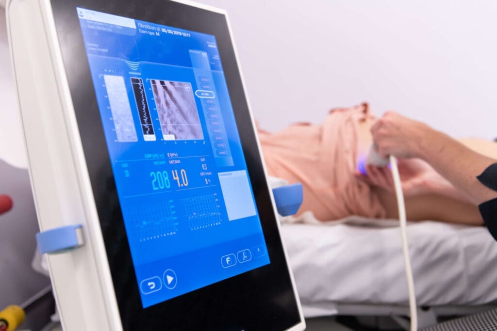 Fibroscan Liver Scanning